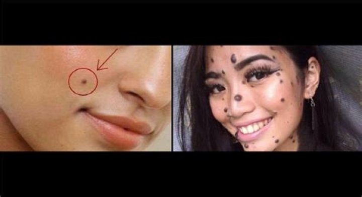 Are most moles harmless?