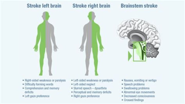 Can a stroke affect your vagina?