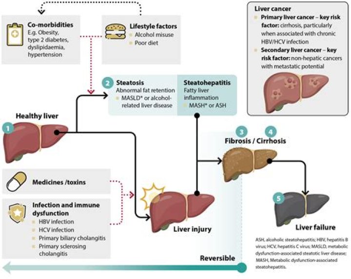 Can liver failure recover?