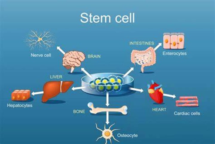 Can stem cell replace hip replacement?