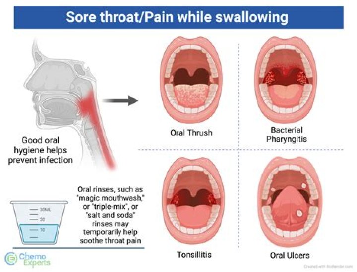 Does botulism cause sore throat?