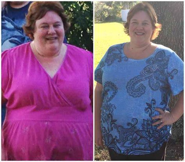 Does losing 20 pounds change your face?