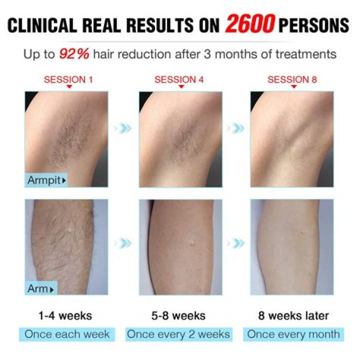 How can I whiten my legs?
