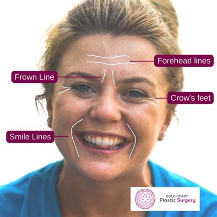 How do I stop my neck from looking old?