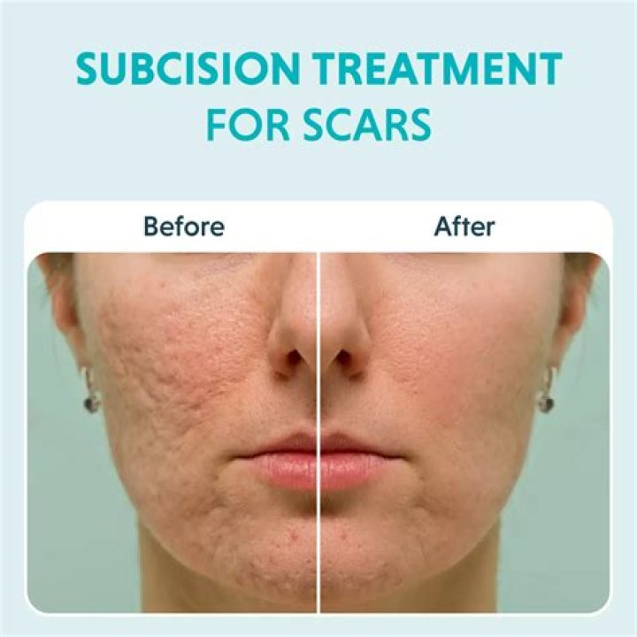 How do you fade surgical scars naturally?