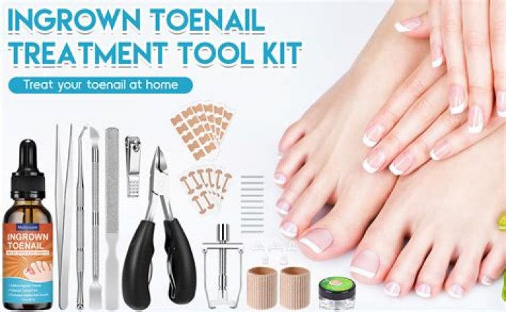 How do you fix ingrown toenails?