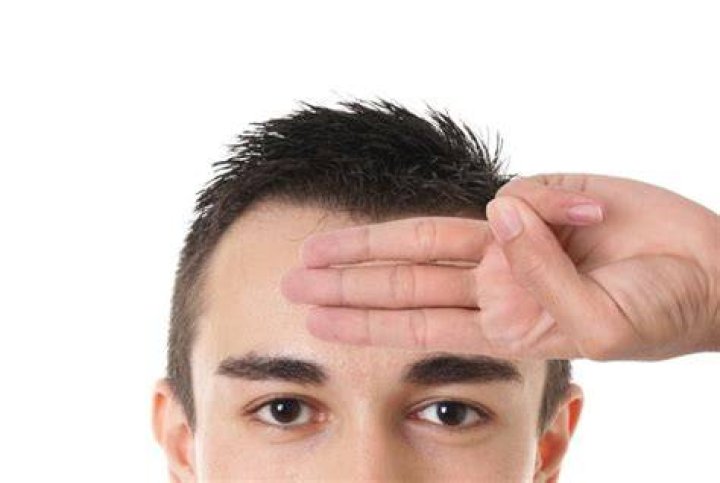 How many fingers is a big forehead?