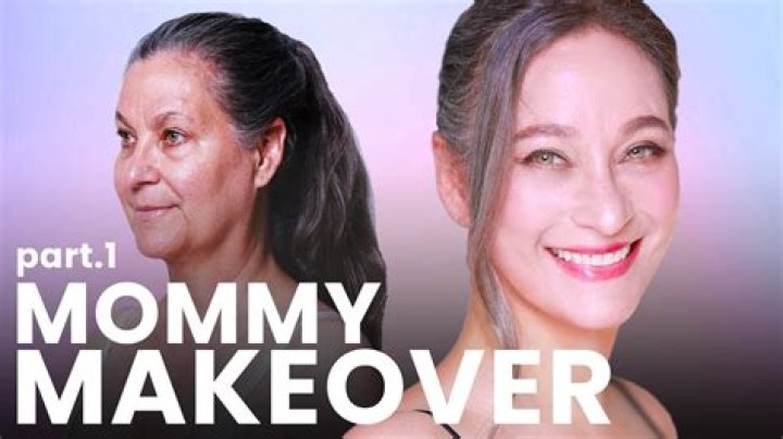 How soon can I go back to work after a mommy makeover?