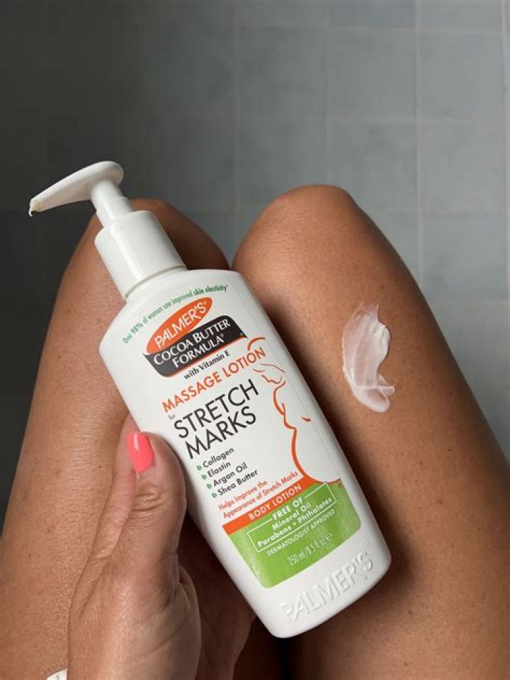 Is baby oil good for stretch marks?