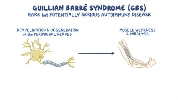 Is guillain barre syndrome a possible side effect of the COVID-19 vaccine?