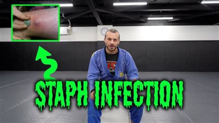 Is staph caused by being dirty?