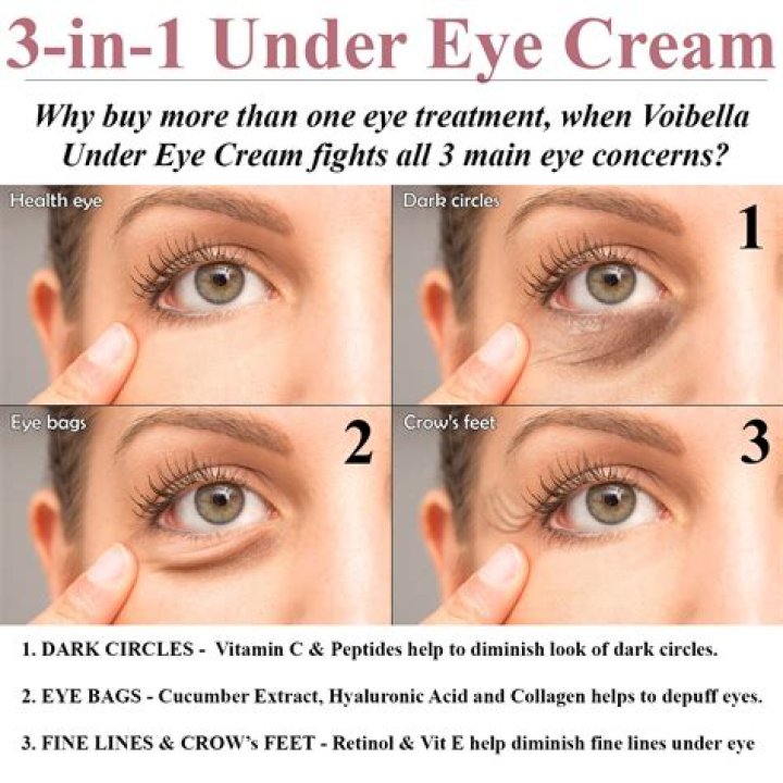 Is vitamin C good for dark circles?
