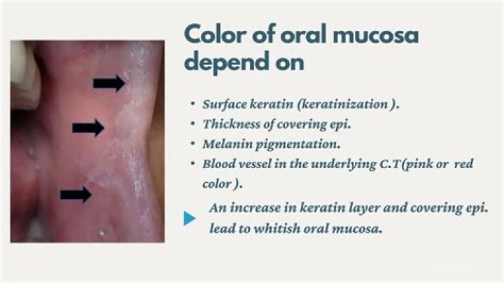 What color is oral mucosa?