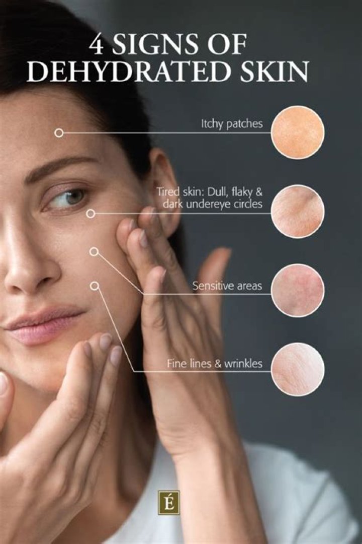 What does it mean when your skin doesn't bounce back?