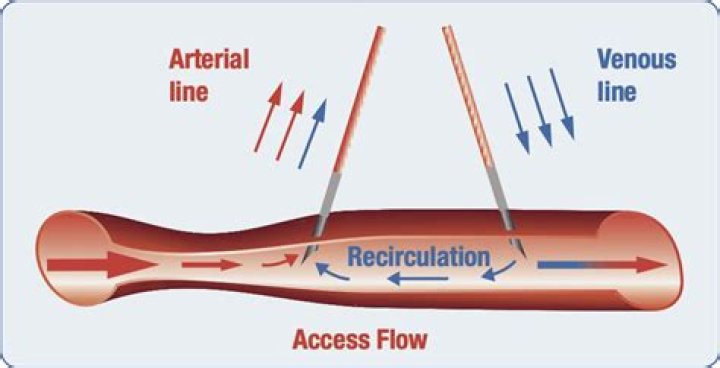 What is recirculation flow?