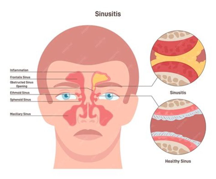 Where did the word snot come from?