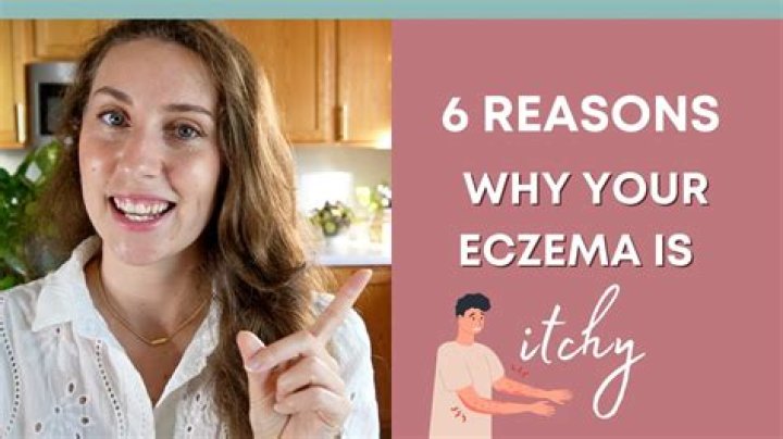 Why is eczema itchy?